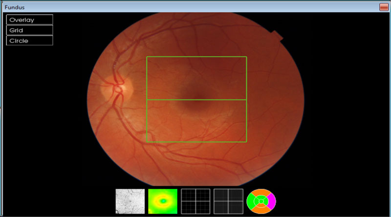 oct fundus